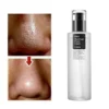 cosrx-bha-blackhead-power-liquid-100ml-beauty-285_600x