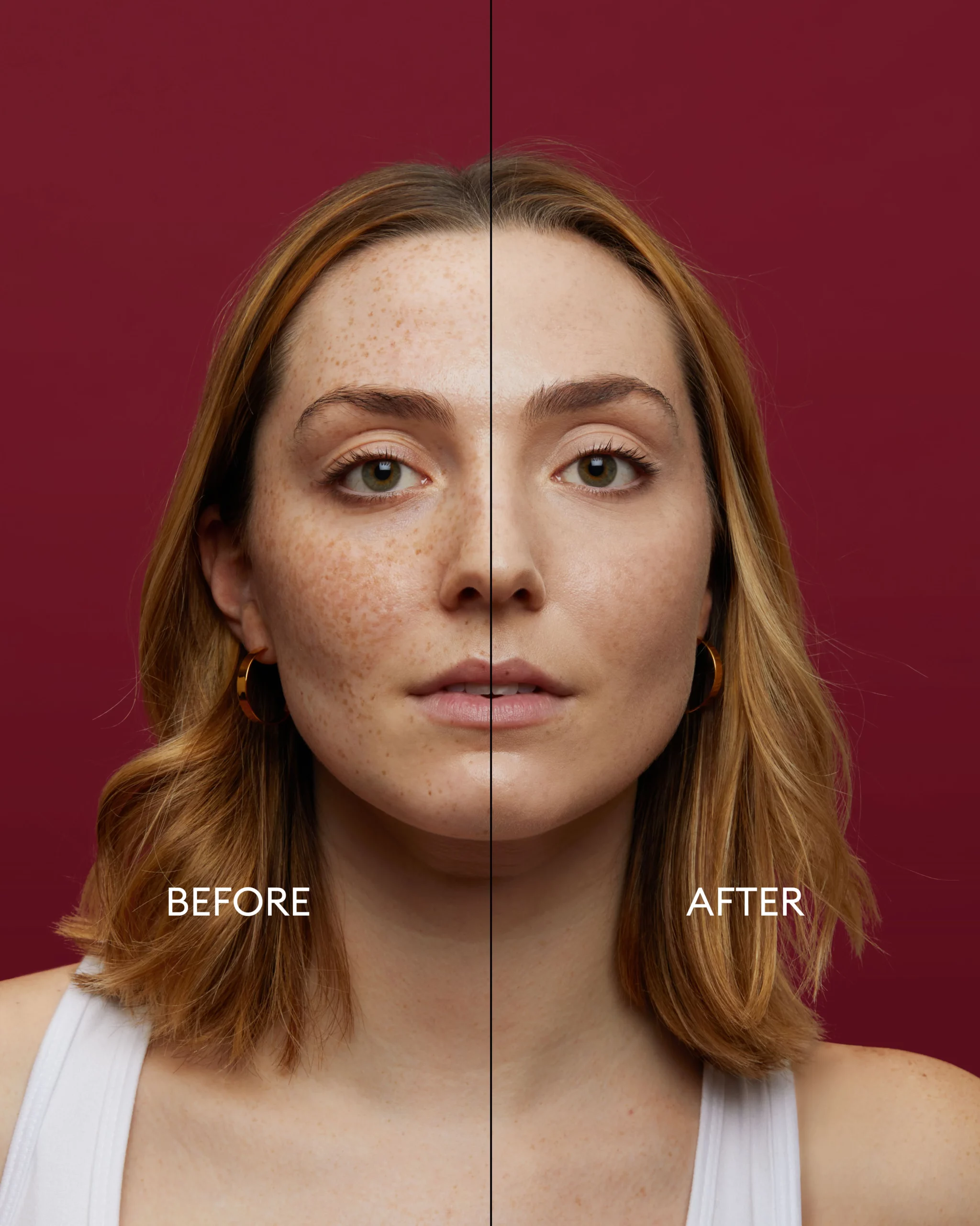 Before---After-V2