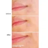 somebymi-spot-patch7_1024x1024