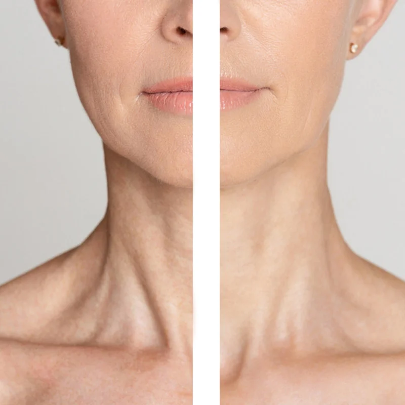 krem-dlya-shiyi-ta-dekolte-z-peptidami-medi-peel-naite-thread-neck-cream