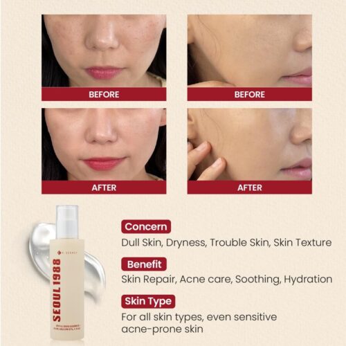 Alternative view of K-SECRET - SEOUL 1988 Essence : Snail Mucin 97% + Rice mitrinoša esence - serums