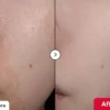 eqqualberryvitaminCserum_3