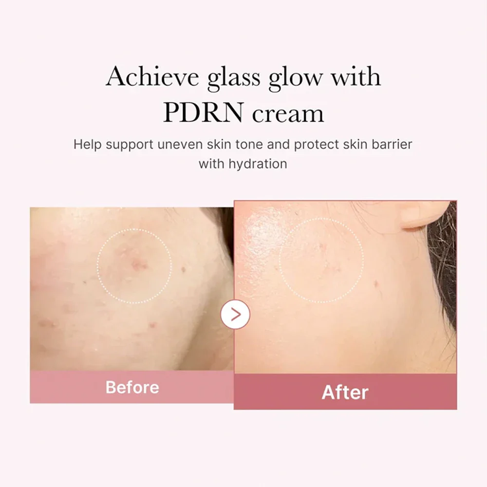 medicube-pdrn-pink-hyaluronic-moisturizing-cream-2-1000x1000-1