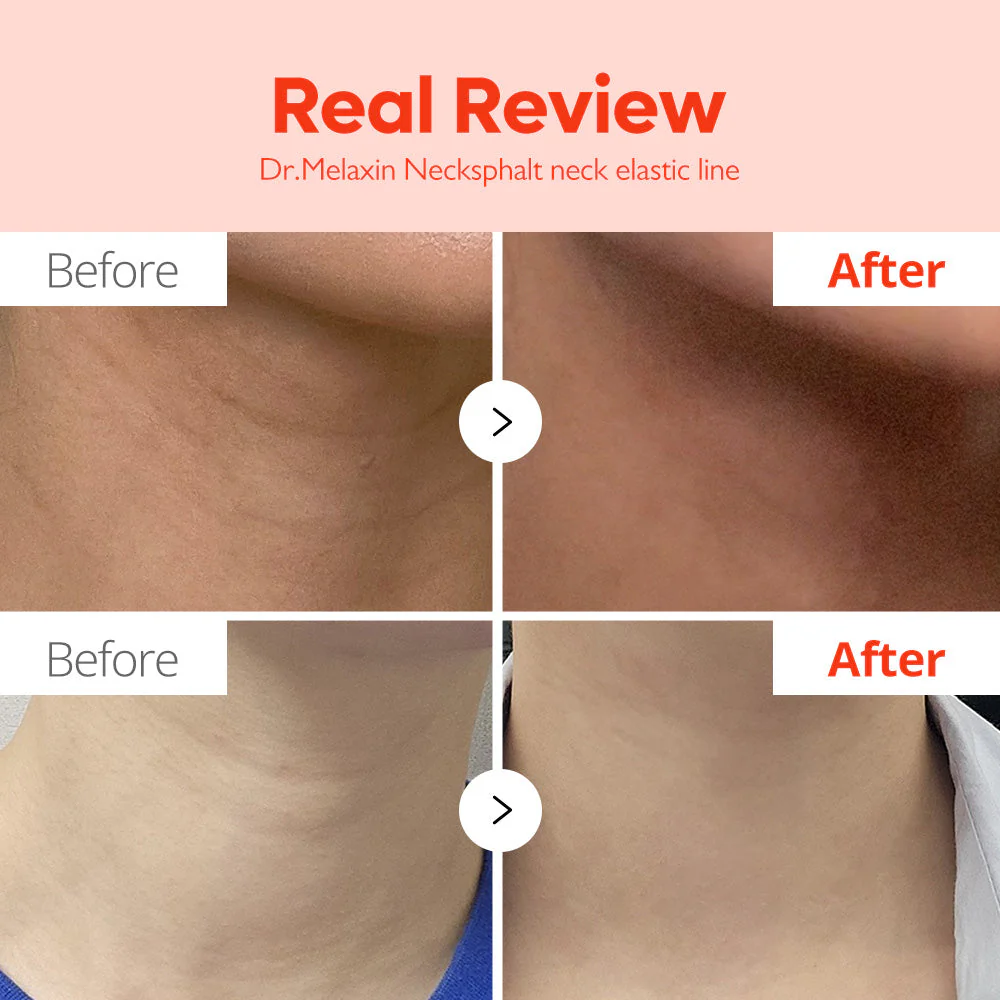 DR.MELAXIN_Necksphalt_ECM_Neck_Barrier_Ampoule_1.5ml_2_2048x