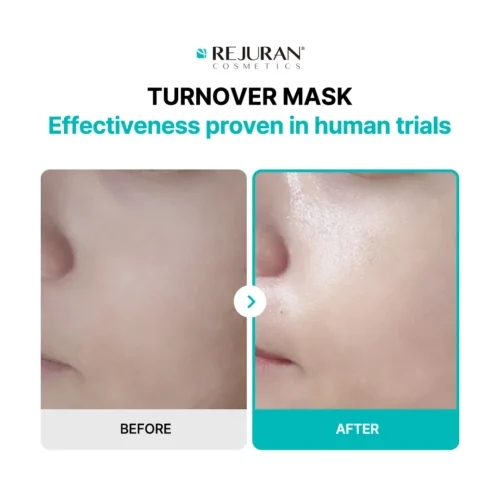 Alternative view of Rejuran Turnover Mask PDRN nomierinoša un atjaunojoša sejas maska
