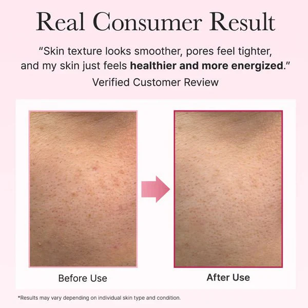 sunu-atjaunojoss-serums-ar-pdrn-arencia-pdrn-booster-shot-8111075